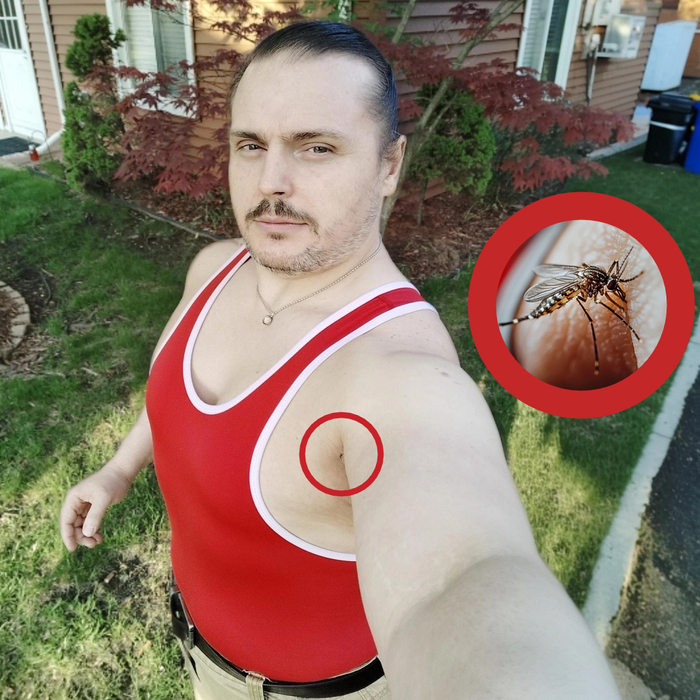Bitten By A Mosquito Already? That May Be An Indication Of A Serious Condition!